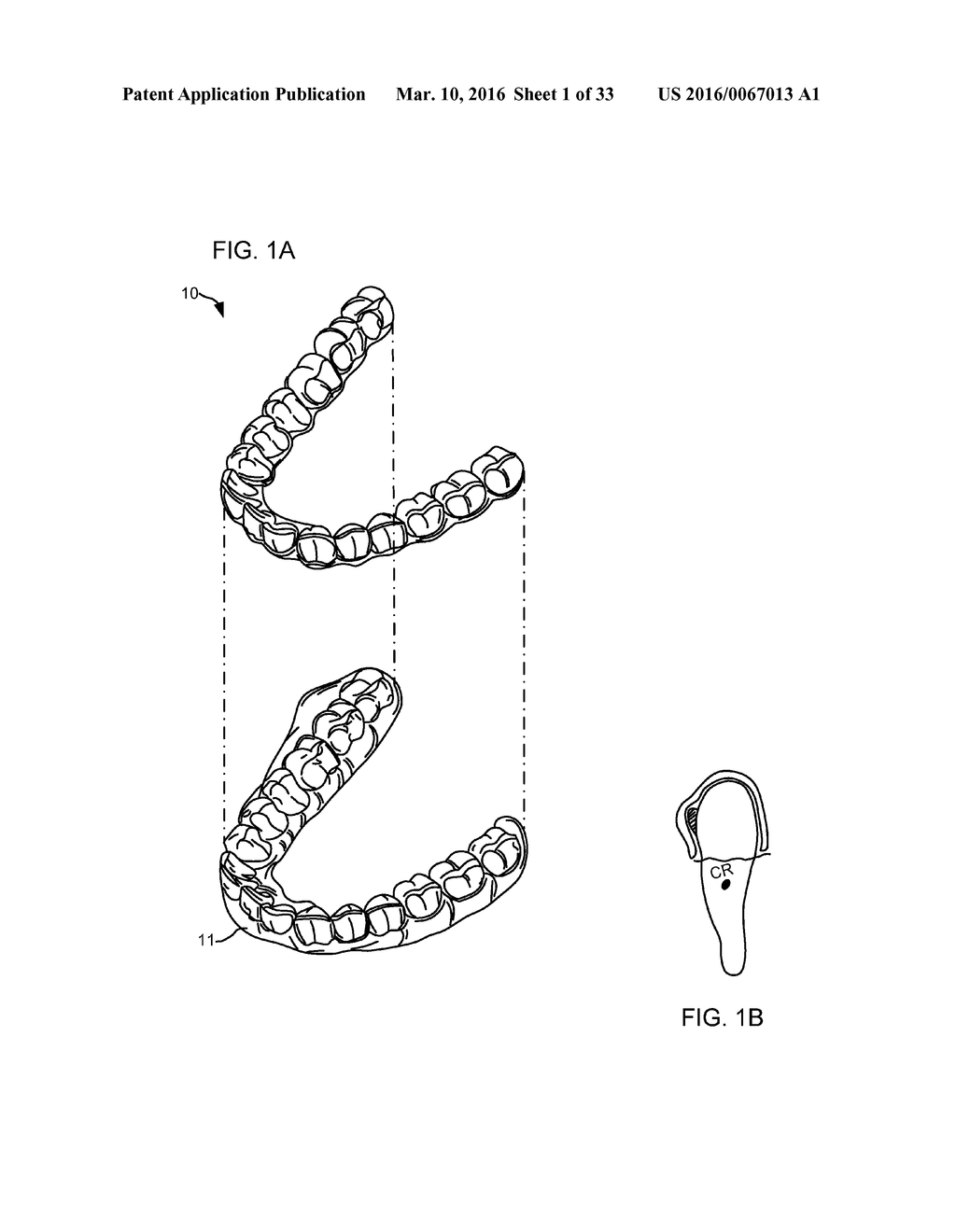 ORTHODONTIC SYSTEMS AND METHODS INCLUDING PARAMETRIC ATTACHMENTS - diagram, schematic, and image 02