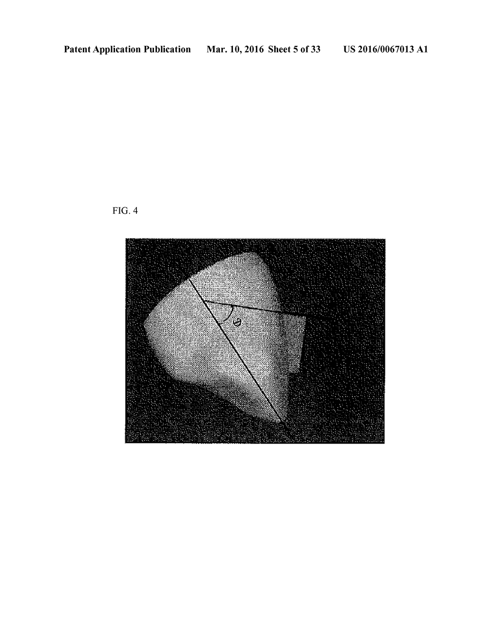 ORTHODONTIC SYSTEMS AND METHODS INCLUDING PARAMETRIC ATTACHMENTS - diagram, schematic, and image 06