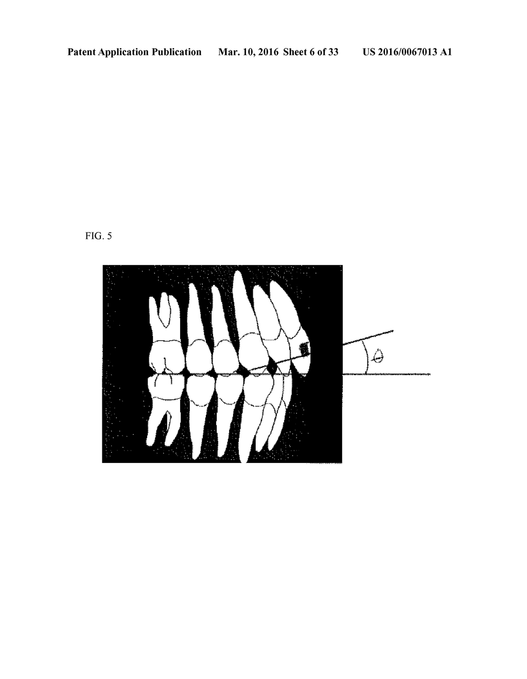 ORTHODONTIC SYSTEMS AND METHODS INCLUDING PARAMETRIC ATTACHMENTS - diagram, schematic, and image 07