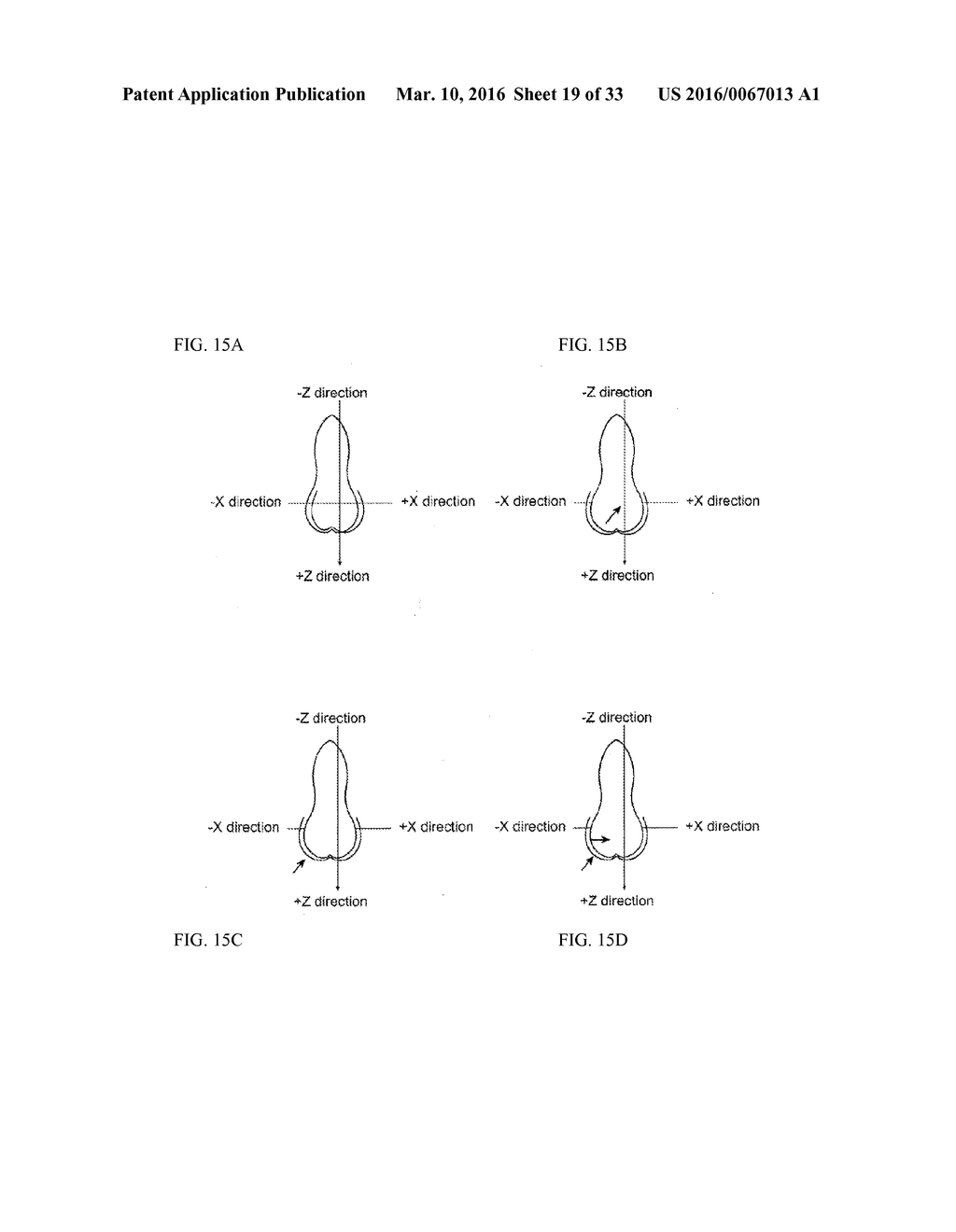 ORTHODONTIC SYSTEMS AND METHODS INCLUDING PARAMETRIC ATTACHMENTS - diagram, schematic, and image 20