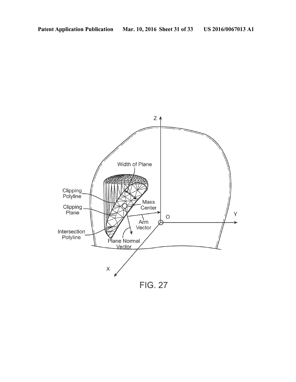 ORTHODONTIC SYSTEMS AND METHODS INCLUDING PARAMETRIC ATTACHMENTS - diagram, schematic, and image 32