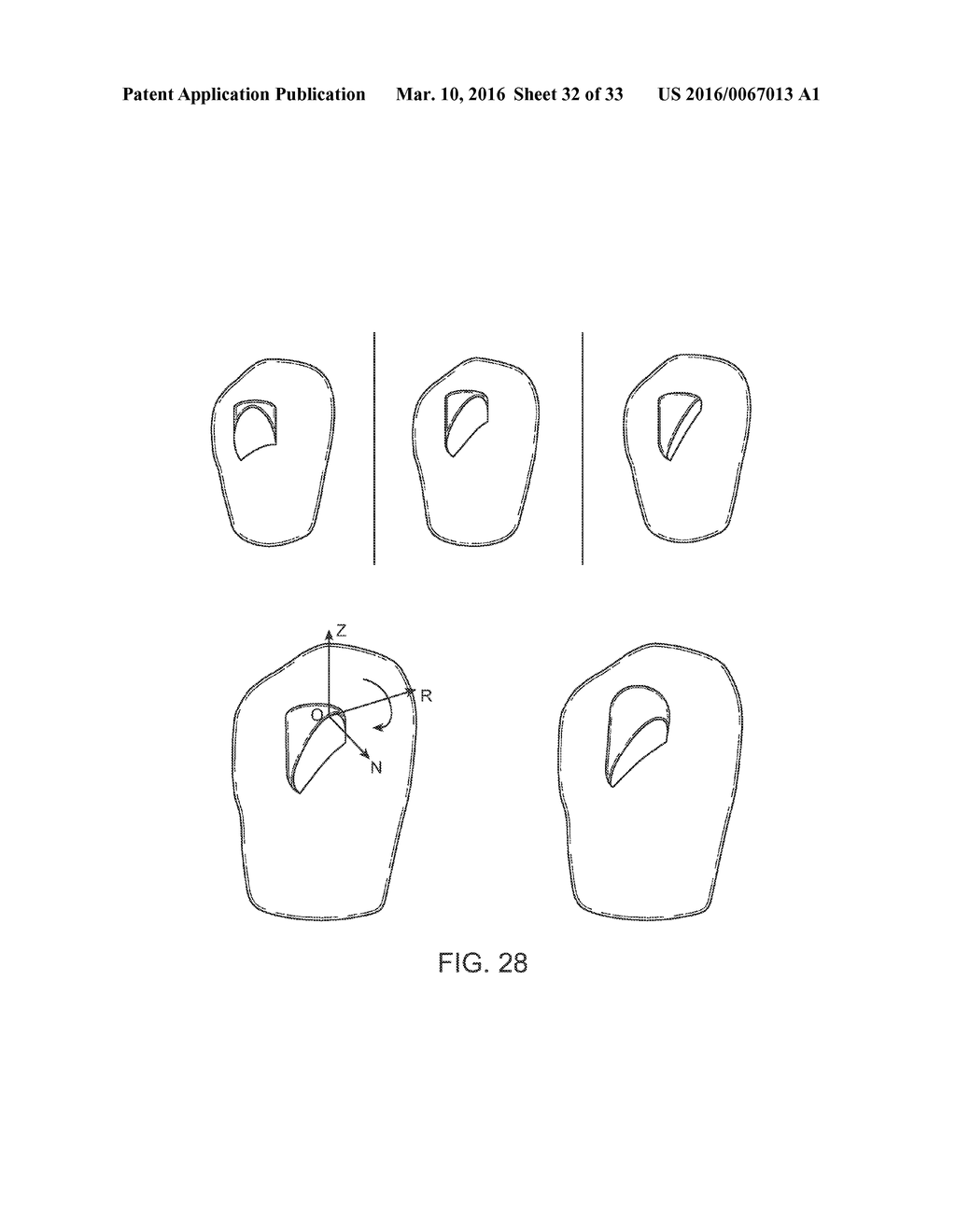 ORTHODONTIC SYSTEMS AND METHODS INCLUDING PARAMETRIC ATTACHMENTS - diagram, schematic, and image 33