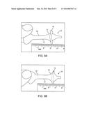 Fecal Incontinence Device, System And Method diagram and image