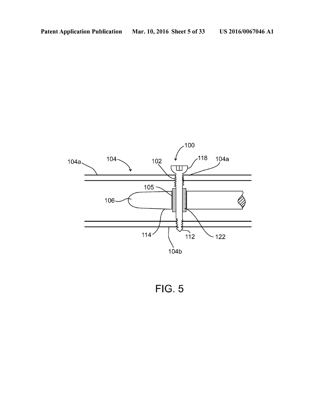 COMPOSITE MATERIAL BONE IMPLANT - diagram, schematic, and image 06