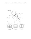 IMPLANTABLE PROSTHESES diagram and image