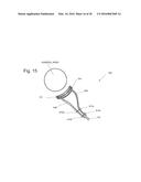 IMPLANTABLE PROSTHESES diagram and image