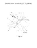 IMPLANTABLE PROSTHESES diagram and image