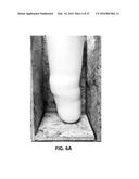 PROSTHESIS COOLING LINER SYSTEM diagram and image