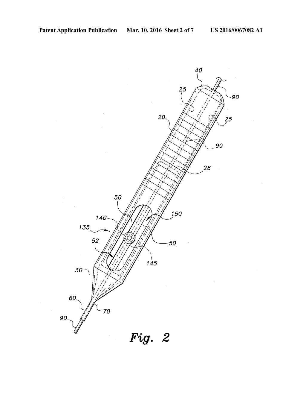 MICRO-BALLOON VITREOUS SEPARATOR - diagram, schematic, and image 03