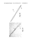 SURGICAL HAND PIECE FOR CATARACT REMOVAL diagram and image