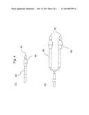 A PORTABLE DEVICE FOR TREATING MENIERE S DISEASE AND SIMILAR CONDITIONS diagram and image