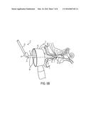 AURAL FOREIGN BODY REMOVAL DEVICE AND RELATED METHODS OF USE AND     MANUFACTURE diagram and image