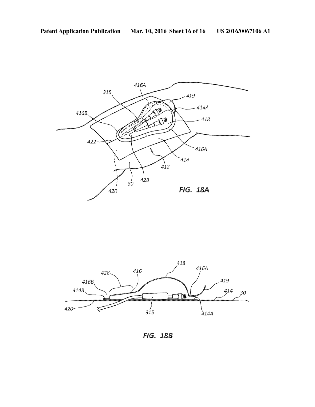 Protective Dressing For Skin-Placed Medical Device - diagram, schematic, and image 17