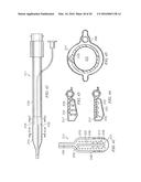 SYSTEM FOR PERCUTANEOUSLY ADMINISTERING REDUCED PRESSURE TREATMENT USING     BALLOON DISSECTION diagram and image