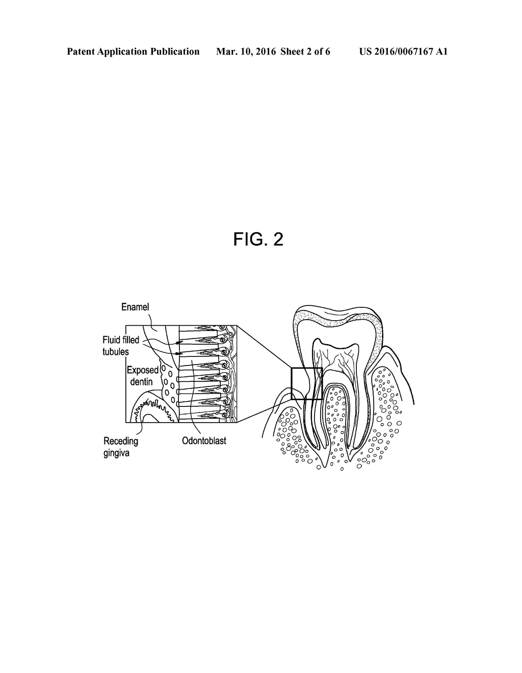 ORAL CARE COMPOSITIONS FOR TREATMENT OF SENSITIVE TEETH - diagram, schematic, and image 03