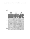 USE OF PHOSPHODIESTERASE 5A INHIBITORS FOR THE TREATMENT OF MUSCULAR     DYSTROPHY diagram and image