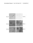 ENTEROCOCCUS FAECALIS BACTERIOPHAGE AND USES THEREOF diagram and image