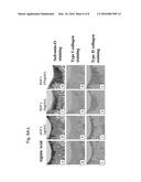 COMPOSITION FOR REGENERATION OF CARTILAGE diagram and image