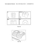 3D BIOMIMETIC, BI-PHASIC KEY FEATURED SCAFFOLD FOR OSTEOCHONDRAL REPAIR diagram and image