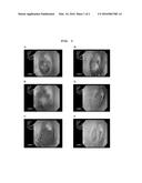 AGENT FOR REGENERATING TYMPANIC MEMBRANE OR EXTERNAL AUDITORY CANAL diagram and image