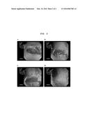 AGENT FOR REGENERATING TYMPANIC MEMBRANE OR EXTERNAL AUDITORY CANAL diagram and image