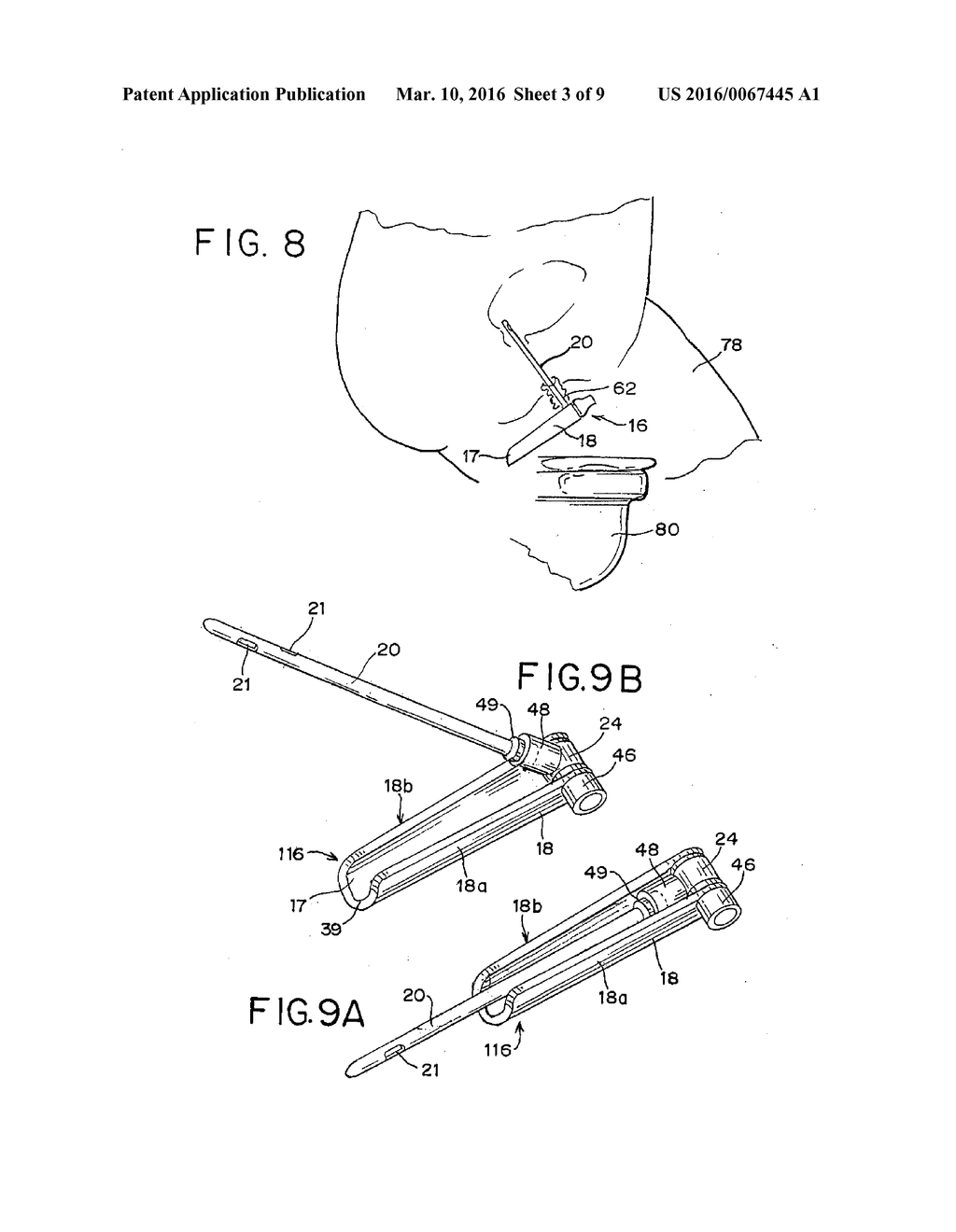 COMPACT CATHETER ASSEMBLY WITH ADJUSTABLE CATHETER TUBE - diagram, schematic, and image 04