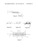 Controlled Burst Flexible Medical Balloon with Axially Constant Radial     Pressure diagram and image