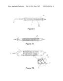 Controlled Burst Flexible Medical Balloon with Axially Constant Radial     Pressure diagram and image