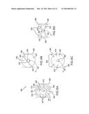 SYSTEMS, METHODS, AND DEVICES ADDRESSING THE GASTRO-INTESTINAL TRACT diagram and image