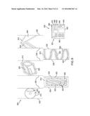 SYSTEMS, METHODS, AND DEVICES ADDRESSING THE GASTRO-INTESTINAL TRACT diagram and image