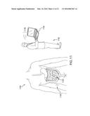 SYSTEMS, METHODS, AND DEVICES ADDRESSING THE GASTRO-INTESTINAL TRACT diagram and image