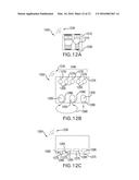 SYSTEMS, METHODS, AND DEVICES ADDRESSING THE GASTRO-INTESTINAL TRACT diagram and image