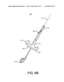 RECEPTACLE FOR PACEMAKER LEAD diagram and image