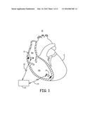 SYSTEM AND METHOD FOR DUAL-CHAMBER PACING diagram and image