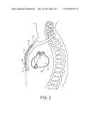 IMPLANTABLE MEDICAL DEVICES HAVING MULTI-CELL POWER SOURCES diagram and image