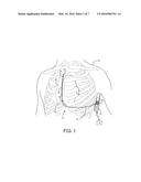 TRANSTHORACIC PROTECTION CIRCUIT FOR IMPLANTABLE MEDICAL DEVICES diagram and image