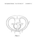 TRANSTHORACIC PROTECTION CIRCUIT FOR IMPLANTABLE MEDICAL DEVICES diagram and image