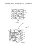 METHODS AND DEVICES FOR TREATING MIGRAINES WITH ELECTROMAGNETIC     STIMULATION diagram and image