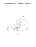 METHODS AND DEVICES FOR TREATING MIGRAINES WITH ELECTROMAGNETIC     STIMULATION diagram and image