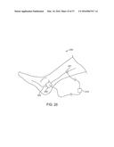 METHODS AND DEVICES FOR TREATING MIGRAINES WITH ELECTROMAGNETIC     STIMULATION diagram and image