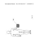 METHODS AND DEVICES FOR TREATING MIGRAINES WITH ELECTROMAGNETIC     STIMULATION diagram and image