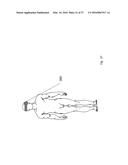 METHODS AND DEVICES FOR TREATING MIGRAINES WITH ELECTROMAGNETIC     STIMULATION diagram and image