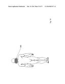 METHODS AND DEVICES FOR TREATING MIGRAINES WITH ELECTROMAGNETIC     STIMULATION diagram and image