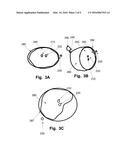 Apparatus And Method For Controlling Immunostimulating Laser Thermotherapy diagram and image