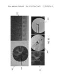 MULTIPLEXED SURFACE ENHANCED RAMAN SENSORS FOR EARLY DISEASE DETECTION AND     IN-SITU BACTERIAL MONITORING diagram and image