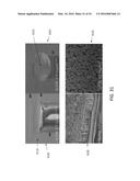 MULTIPLEXED SURFACE ENHANCED RAMAN SENSORS FOR EARLY DISEASE DETECTION AND     IN-SITU BACTERIAL MONITORING diagram and image