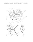 Tire Shield Attachment System diagram and image