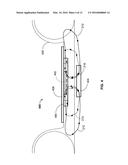 SYSTEM AND METHOD FOR REDUCING LEAKAGE FLUX IN WIRELESS ELECTRIC VEHICLE     CHARGING SYSTEMS diagram and image