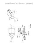 Material Handling Conveyor Vehicle diagram and image