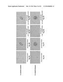 PEPTIDE VACCINE FOR PREVENTION AND IMMUNOTHERAPY OF DEMENTIA OF THE     ALZHEIMER S TYPE diagram and image